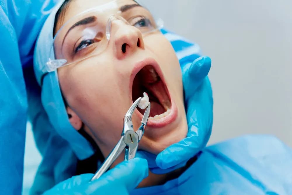 Cirurgia oral e extração de dente em consultório