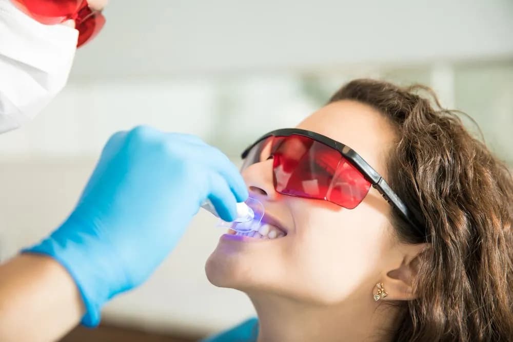 Sorriso com dentes clareados após clareamento dental