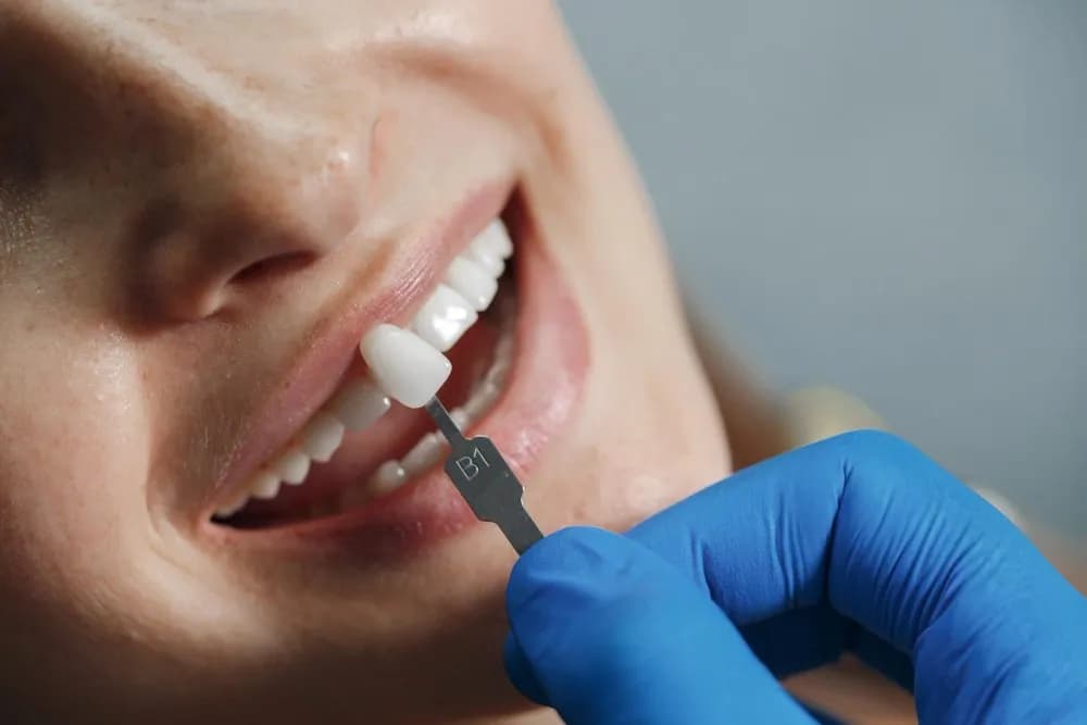 Restauração dental em resina em consultório odontológico