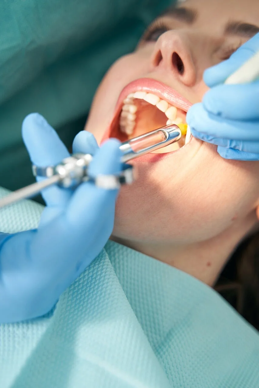 Dentística - Imagem de Seção